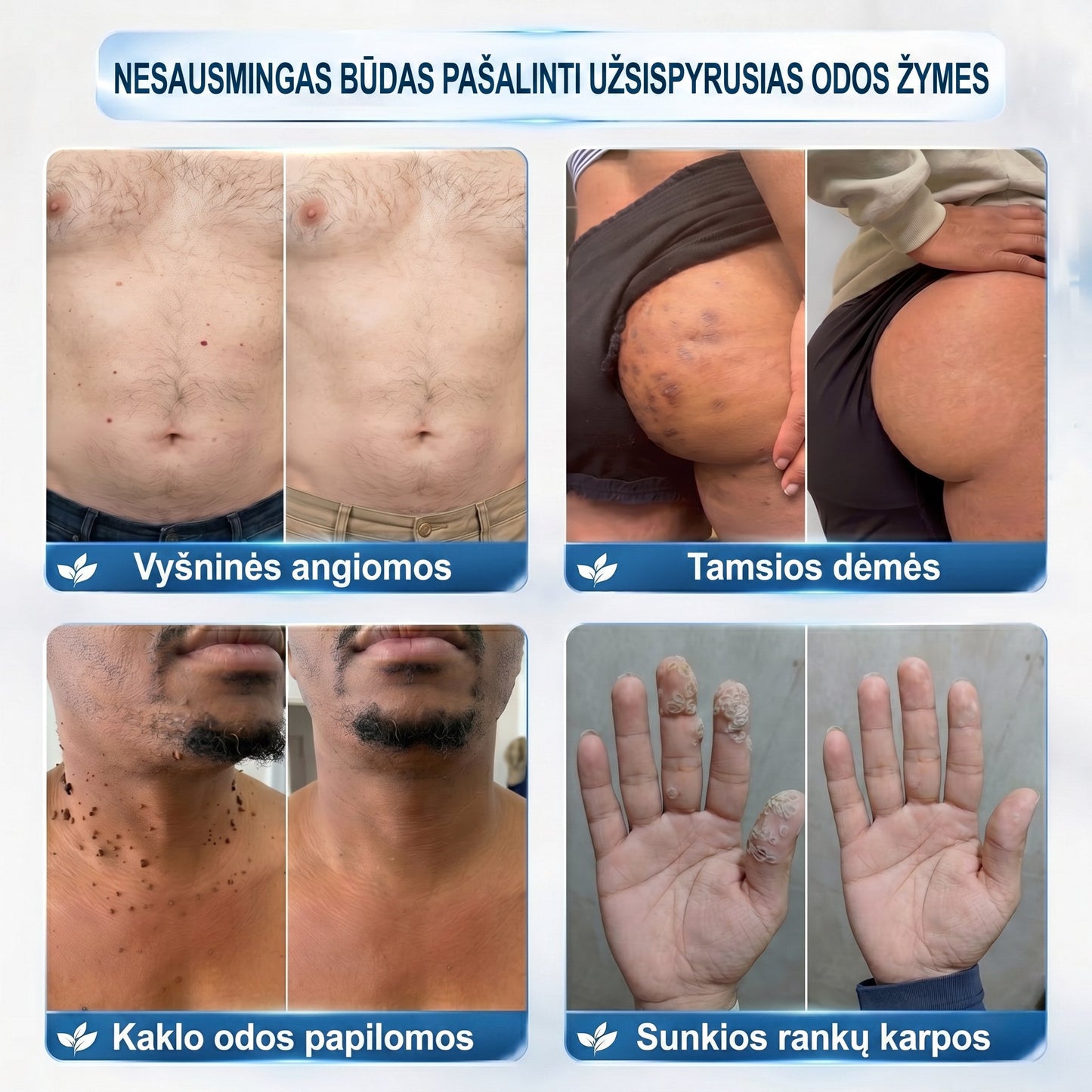 𝐏i𝐜𝐝o® 𝟕 𝐃𝐢𝐞𝐧𝐨𝐬 𝐏𝐢𝐠𝐦𝐞𝐧𝐭𝐢𝐧𝐢ų 𝐃ė𝐦𝐢ų 𝐈𝐫 𝐑𝐚𝐧𝐝ų Š𝐚𝐥𝐢𝐧𝐢𝐦𝐚𝐬 𝐑𝐚š𝐢𝐤𝐥𝐢𝐬💗💗(𝐵𝑒 𝑠𝑘𝑎𝑢𝑠𝑚𝑜, 𝑏𝑒 𝑟𝑎𝑛𝑑ų – 𝑟𝑢𝑡𝑢𝑙𝑖𝑛𝑖𝑠 𝑎𝑝𝑙𝑖𝑘𝑎𝑡𝑜𝑟𝑖𝑢𝑠)💪