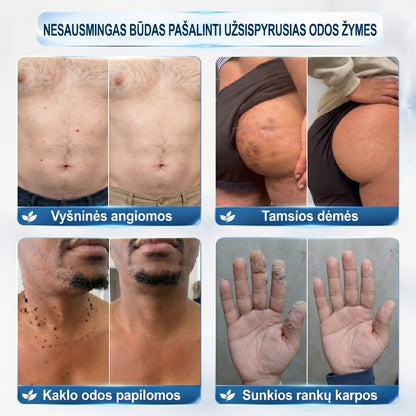 𝐏i𝐜𝐝o® 𝟕 𝐃𝐢𝐞𝐧𝐨𝐬 𝐏𝐢𝐠𝐦𝐞𝐧𝐭𝐢𝐧𝐢ų 𝐃ė𝐦𝐢ų 𝐈𝐫 𝐑𝐚𝐧𝐝ų Š𝐚𝐥𝐢𝐧𝐢𝐦𝐚𝐬 𝐑𝐚š𝐢𝐤𝐥𝐢𝐬💗💗(𝐵𝑒 𝑠𝑘𝑎𝑢𝑠𝑚𝑜, 𝑏𝑒 𝑟𝑎𝑛𝑑ų – 𝑟𝑢𝑡𝑢𝑙𝑖𝑛𝑖𝑠 𝑎𝑝𝑙𝑖𝑘𝑎𝑡𝑜𝑟𝑖𝑢𝑠)💪