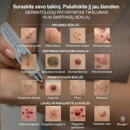 𝐏i𝐜𝐝o® 𝟕 𝐃𝐢𝐞𝐧𝐨𝐬 𝐏𝐢𝐠𝐦𝐞𝐧𝐭𝐢𝐧𝐢ų 𝐃ė𝐦𝐢ų 𝐈𝐫 𝐑𝐚𝐧𝐝ų Š𝐚𝐥𝐢𝐧𝐢𝐦𝐚𝐬 𝐑𝐚š𝐢𝐤𝐥𝐢𝐬💗💗(𝐵𝑒 𝑠𝑘𝑎𝑢𝑠𝑚𝑜, 𝑏𝑒 𝑟𝑎𝑛𝑑ų – 𝑟𝑢𝑡𝑢𝑙𝑖𝑛𝑖𝑠 𝑎𝑝𝑙𝑖𝑘𝑎𝑡𝑜𝑟𝑖𝑢𝑠)💪