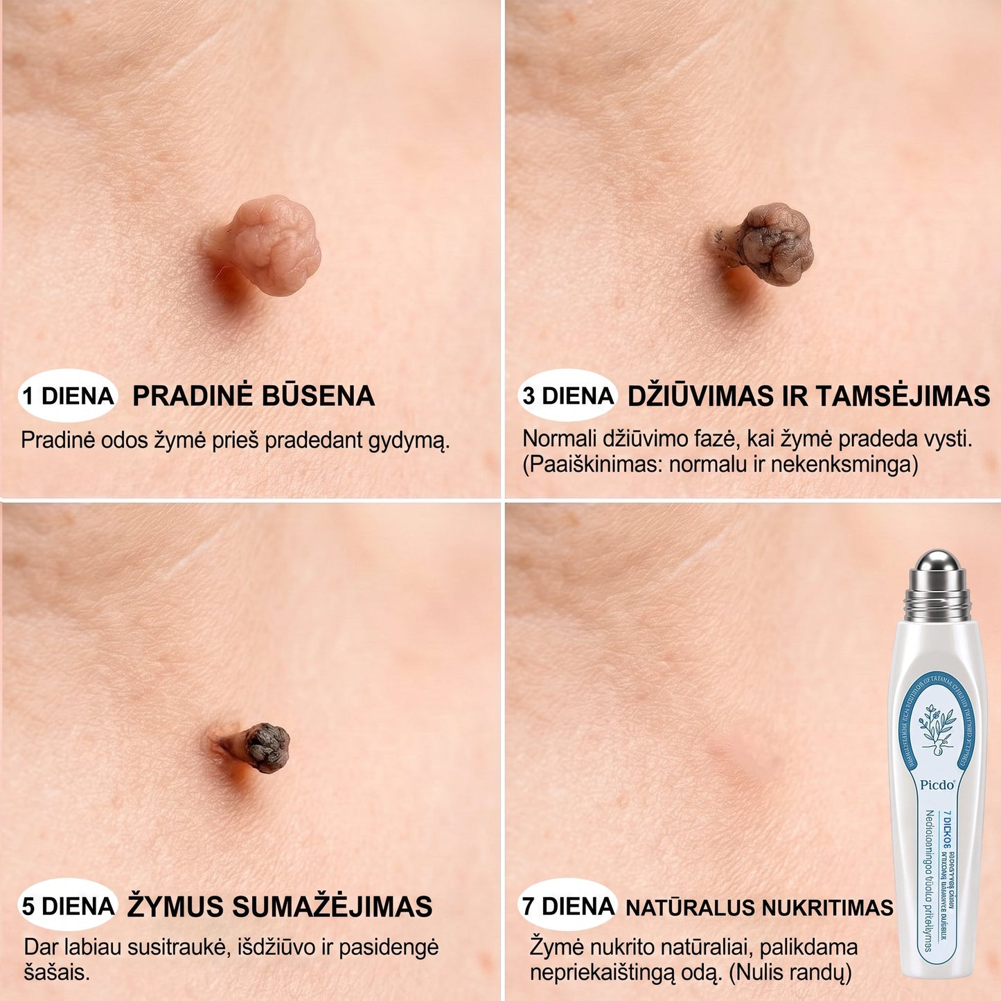 𝐏i𝐜𝐝o® 𝟕 𝐃𝐢𝐞𝐧𝐨𝐬 𝐏𝐢𝐠𝐦𝐞𝐧𝐭𝐢𝐧𝐢ų 𝐃ė𝐦𝐢ų 𝐈𝐫 𝐑𝐚𝐧𝐝ų Š𝐚𝐥𝐢𝐧𝐢𝐦𝐚𝐬 𝐑𝐚š𝐢𝐤𝐥𝐢𝐬💗💗(𝐵𝑒 𝑠𝑘𝑎𝑢𝑠𝑚𝑜, 𝑏𝑒 𝑟𝑎𝑛𝑑ų – 𝑟𝑢𝑡𝑢𝑙𝑖𝑛𝑖𝑠 𝑎𝑝𝑙𝑖𝑘𝑎𝑡𝑜𝑟𝑖𝑢𝑠)💪