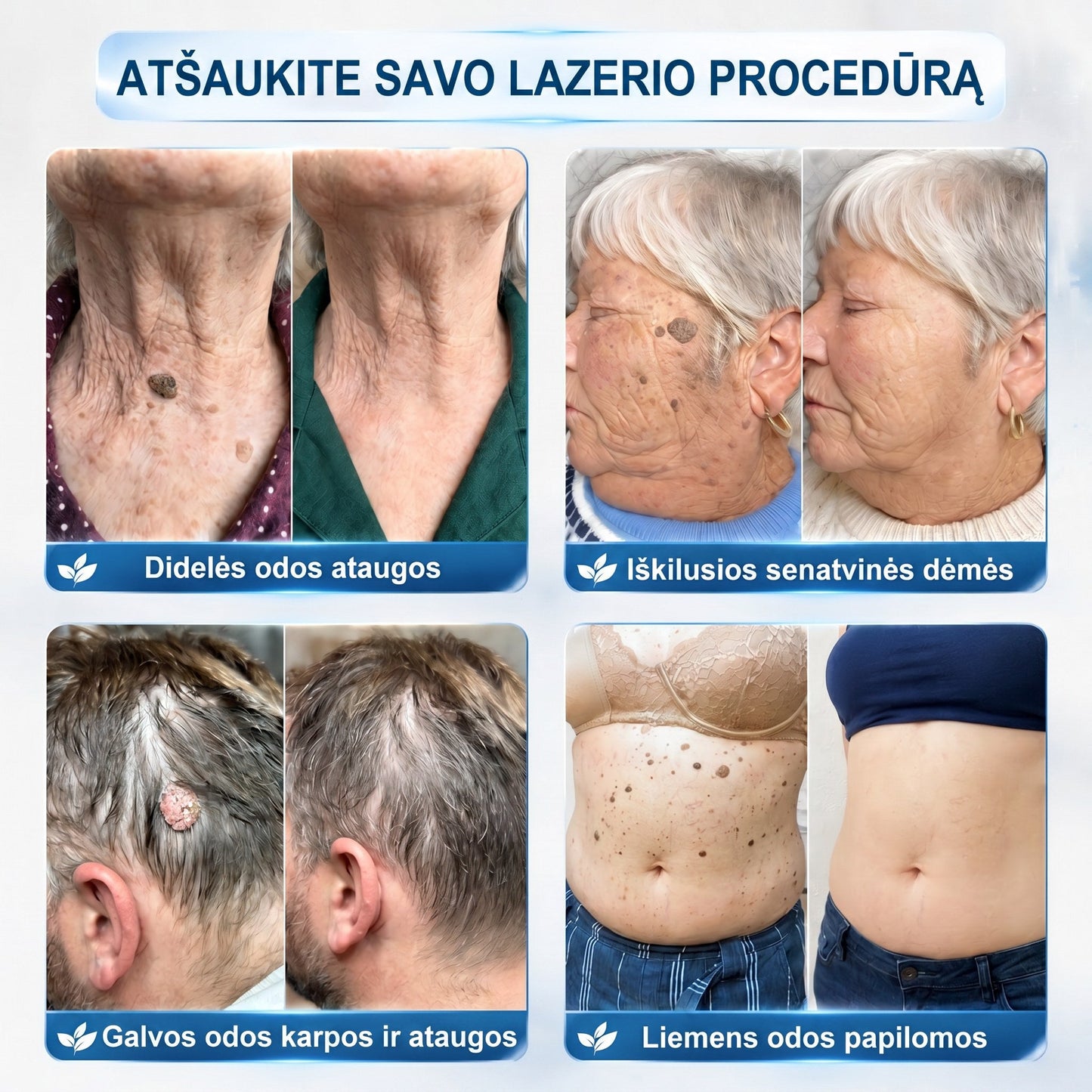 𝐏i𝐜𝐝o® 𝟕 𝐃𝐢𝐞𝐧𝐨𝐬 𝐏𝐢𝐠𝐦𝐞𝐧𝐭𝐢𝐧𝐢ų 𝐃ė𝐦𝐢ų 𝐈𝐫 𝐑𝐚𝐧𝐝ų Š𝐚𝐥𝐢𝐧𝐢𝐦𝐚𝐬 𝐑𝐚š𝐢𝐤𝐥𝐢𝐬💗💗(𝐵𝑒 𝑠𝑘𝑎𝑢𝑠𝑚𝑜, 𝑏𝑒 𝑟𝑎𝑛𝑑ų – 𝑟𝑢𝑡𝑢𝑙𝑖𝑛𝑖𝑠 𝑎𝑝𝑙𝑖𝑘𝑎𝑡𝑜𝑟𝑖𝑢𝑠)💪